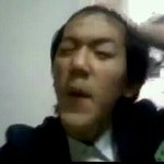 [EXO] 백현 <b>양악</b>수술전 사진이나봐