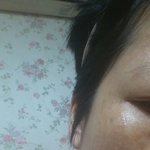 <b>기미</b>없애려구 스피니4를 구입했는데  효과없네요.