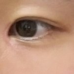 [댓글부탁해] <b>쌍수</b>했는데