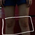 [댓글부탁해] (사진) 내 다리 골격이 이상한거?