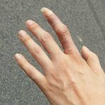 [엽기사건] CRPS 환자를 함부로 다루는 쓰레기집단