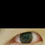 나 쌍꺼풀 <b>유무</b> 차이 어떰