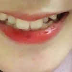 웃을때 이빨때문에 너무 신경<b>쓰임</b>ㅜㅜ
