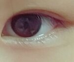 [댓글부탁해] 나 <b>쌍꺼풀라인</b> 괜찮아?