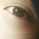 [댓글부탁해] 사진있음(쌍수 잘됐는지 봐주라ㅠㅠ