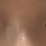[댓글부탁해] 쌍수한지 두달 반 지났는데 짝짝이야ㅠㅠㅠㅠㅠ