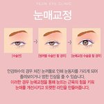[댓글부탁해] <b>눈매</b>교정 해본 애들아 이거진짜양??