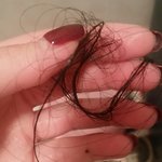 [조언부탁] 모닝와이드 탈모남과 같은<b>사연</b>입니다 ..어떻게해야하나요