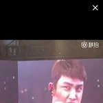 [EXO] 디오 자기<b>관리</b> 너무 안한다