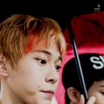 [NCT] 도영이 입가에 <b>상처</b>