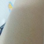 제모하고 <b>자국</b> 어떡함 ㅠㅠㅠ