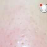 [조언부탁해] +) (혐)도와줘 내<b>코에</b>빵꾸낫어ㅠㅠ