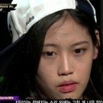 [댓글부탁해] 이런 <b>이마</b> 어떻게해?