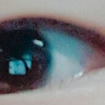 나 안검<b>하수</b>인지 좀 봐줘 ㅠㅡㅠ