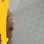 [조언부탁해] 교정 해야될까? <b>입</b> 많이 나왔어?
