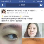 쌍수충동 부르는 쌍꺼풀수술 성공한 페북스타 최마리 후기 (+스압...