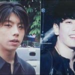 [진짜궁금] 궁금한거 있는데 <b>돌출</b>입 교정하면 어떤게 바껴??