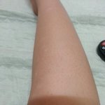 [댓글부탁해] [약혐]다리에 계속 이상한게 나ㅜㅜ