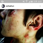 [세훈] 160523 훈스타그램3
