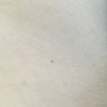 [꼭댓글부탁] 혹시 이런 빨간 <b>점</b> 생기신 분 계시나요??ㅠㅠ