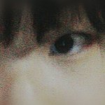 [댓글부탁해] 앞트임 할까말까 ㅠㅠ