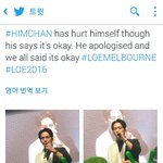 [BAP] 찬이 <b>팔</b> 다쳤어?