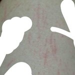 [댓글부탁해] <b>눈썹칼</b> 베였다는 쓰닌데 사진