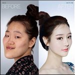 와 <b>역대</b>급 성형성공..