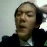 [EXO] 백현 <b>양악</b>성형수술전 사진봤어? 