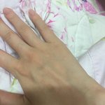 여자손인데 손 근육 <b>적음</b>?보통?많음?