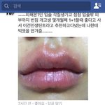 <b>아모레</b>퍼시픽 아리따움 볼륨업틴트 부작용 호소 '폭주'