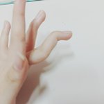 [댓글부탁해] 사진)너희 <b>신체</b>에서 이상한거 자랑해봐ㅇㅇ