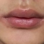 [댓글부탁해] 얘들아 혹시 <b>입술</b> 이렇게 되본적 있는애 있어??