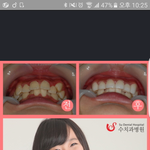 [댓글부탁해] <b>이</b><b>여자</b>케이<b>닮음</b>