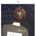 [EXO] 찬열이 두피자극땜에 탈모있나봐;;