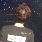 [드루와] 엑소 찬열 <b>탈모</b>