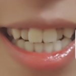 [댓글부탁해] 내<b>덧니</b> 매력잇지않음?