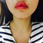 [조언부탁해] 나 입술ㅠㅠㅠㅠㅠ