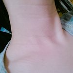 [댓글부탁해] 목주름이 너무 심해요ㅠㅠㅠ