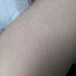 [혐주의] 몸에 털이 너무 많이 나는데 진짜 빠질까???