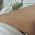 여잔데 몸에 정말 털이 많음 ㅠ.ㅠ