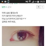 [댓글부탁해] 이거 앞트임 ㅈ<b>망인</b>거지?