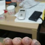 살면서 자랑스럽게 생각하는 <b>흉터</b>같은 그런거 있어?