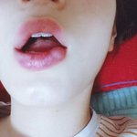 [도와줘] <b>입술</b>에 이상한게 생김