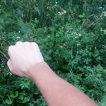 팔이 탓는데 다시 돌아올수있음???