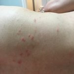 [댓글부탁해] 피부염? 아토피? 비강진? 뭘까요ㅠ