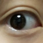 얘들아 <b>동공</b> 이정도크기면 렌즈직경 몇껴야돼????
