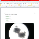 [개깊은빡침] <b>처방</b> 받은 약품 이물질(제약회사 반응)사진 有