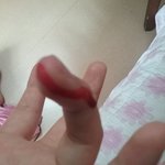 <b>햄스터</b>한테 물려서 피가 너무많이남