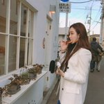 원래 이마성형하면 이래 <b>티나</b>?